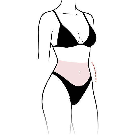 Flatter
